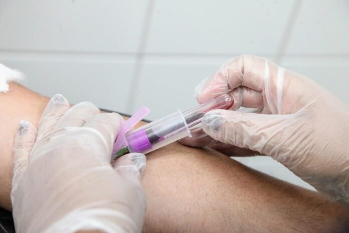 Lei assegura prioridade a diabéticos em exame