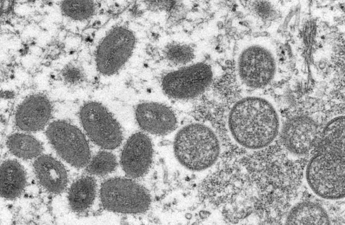 Varíola dos macacos: Brasil chega a oito casos confirmados