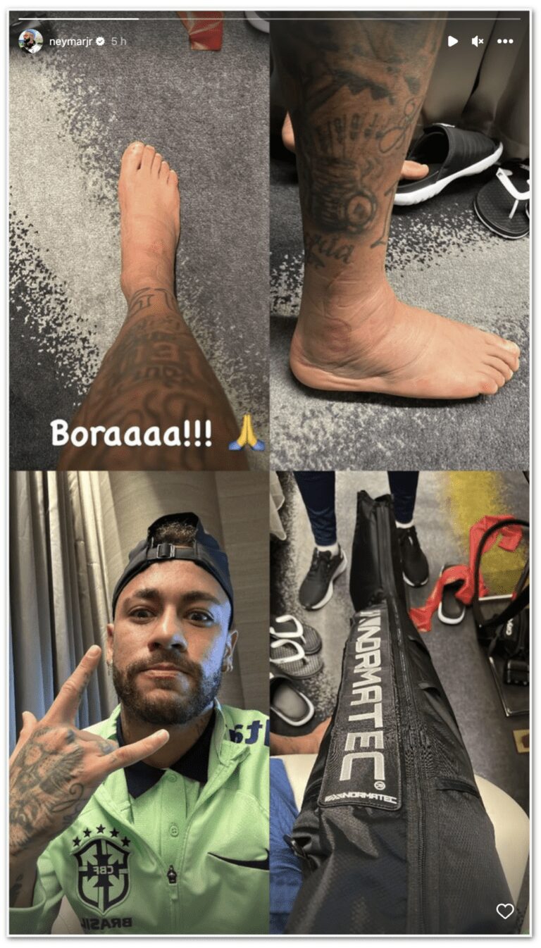 Alvo de ironias por lesão, Neymar mostra tornozelo inchado
