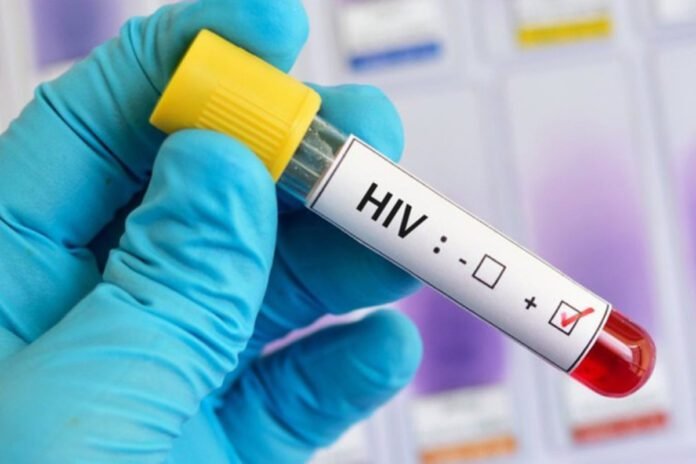 Casos de HIV/Aids aumentam 60% em 10 anos